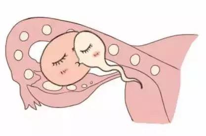 success story
